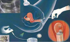 成都试管生孩子服务〗成都试管生孩子服务中心